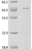 Human Cyclin-dependent kinase 7 (CDK7) Recombinant Protein, C-His - BioCrest Sci