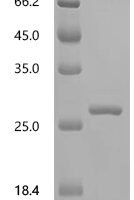 Macaca mulatta Tumor necrosis factor (TNF) , partial Recombinant Protein - BioCrest Sci