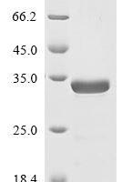 Severe acute respiratory syndrome coronavirus 2 Nucleoprotein (N), partial Recombinant Protein - BioCrest Sci