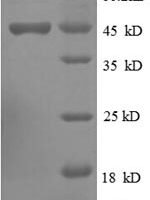 Human Ubiquitin-like protein ISG15 (Isg15) Recombinant Protein, N-GST - BioCrest Sci