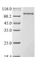 Human Nuclear cap-binding protein subunit 1 (NCBP1) Recombinant Protein - BioCrest Sci