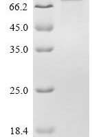 Chicken Low-density lipoprotein receptor-related protein 1 (LRP1), partial Recombinant Protein, C-hFc1 - BioCrest Sci