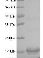 Macaca mulatta Interleukin-10 (IL10) Recombinant Protein, N-His - BioCrest Sci