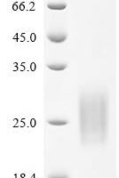 Macaca fascicularis Gastric inhibitory polypeptide receptor (GIPR), partial Recombinant Protein - BioCrest Sci