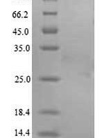 Gloydius blomhoffii Disintegrin halysin Recombinant Protein - BioCrest Sci
