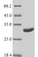 Polistes fuscatus Venom allergen 5 Recombinant Protein - BioCrest Sci