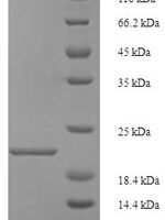 Rat Regenerating islet-derived protein 3-gamma (Reg3g) Recombinant Protein - BioCrest Sci