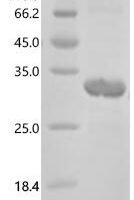 Human N(4)-(beta-N-acetylglucosaminyl)-L-asparaginase (AGA), partial Recombinant Protein - BioCrest Sci