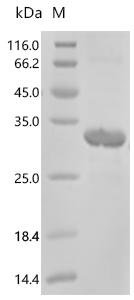 Human N(4)-(beta-N-acetylglucosaminyl)-L-asparaginase (AGA), partial Recombinant Protein, Homo sapiens (Human), E.coli, C-terminal 6xHis-tagged, 26.5 kDa, purity >≥ 85% as determined by SDS-PAGE.