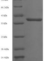 Human Gem-associated protein 7 (GEMIN7) Recombinant Protein - BioCrest Sci