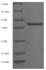 Human Gem-associated protein 7 (GEMIN7) Recombinant Protein, Homo sapiens (Human), E.coli, N-terminal GST-tagged, 41.5 kDa, purity >≥ 90% as determined by SDS-PAGE.