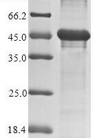 Human adenovirus F serotype 40 Hexon protein (L3), partial Recombinant Protein - BioCrest Sci