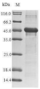 Human adenovirus F serotype 40 Hexon protein (L3), partial Recombinant Protein, Human adenovirus F serotype 40 (HAdV-40) (Human adenovirus 40), E.coli, N-terminal 10xHis-SUMO-tagged and C-terminal Myc-tagged, 40.8 kDa, purity >≥ 85% as determined by SDS-PAGE.