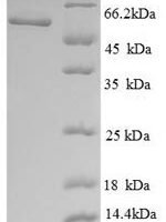 Human Phosphatidylcholine-sterol acyltransferase (LCAT), partial Recombinant Protein - BioCrest Sci