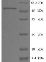 Human L-aminoadipate-semialdehyde dehydrogenase-phosphopantetheinyl transferase (AASDHPPT) Recombinant Protein - BioCrest Sci