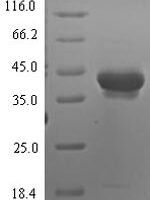 Human Neurotrypsin (PRSS12), partial Recombinant Protein - BioCrest Sci
