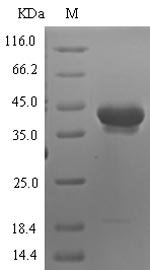 Human Neurotrypsin (PRSS12), partial Recombinant Protein, Homo sapiens (Human), E.coli, N-terminal 6xHis-SUMO-tagged, 43.4 kDa, purity >≥ 90% as determined by SDS-PAGE.