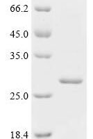 Human Patatin-like phospholipase domain-containing protein 4 (PNPLA4) Recombinant Protein - BioCrest Sci