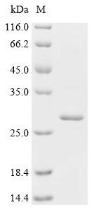 Human Patatin-like phospholipase domain-containing protein 4 (PNPLA4) Recombinant Protein, Homo sapiens (Human), E.coli, C-terminal 6xHis-tagged, 29.1 kDa, purity >≥ 90% as determined by SDS-PAGE.
