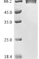 Severe acute respiratory syndrome coronavirus 2 Spike glycoprotein (S), partial Recombinant Protein, N-His-PDI - BioCrest Sci