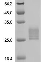 Rat Interleukin-6(Il6) Recombinant Protein - BioCrest Sci