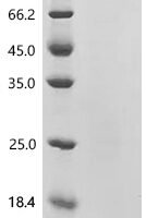 Mouse LIM domain and actin-binding protein 1 (Lima1) Recombinant Protein - BioCrest Sci