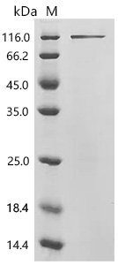 Mouse LIM domain and actin-binding protein 1 (Lima1) Recombinant Protein, Mus musculus (Mouse), E.coli, C-terminal 6xHis-tagged, 91.0 kDa, purity >≥ 85% as determined by SDS-PAGE.