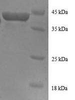 Human 40S ribosomal protein S16 (RPS16), partial Recombinant Protein - BioCrest Sci