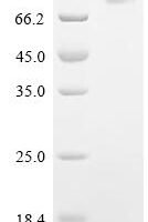 Porcine epidemic diarrhea virus Spike glycoprotein (S), partial Recombinant Protein, C-10His - BioCrest Sci