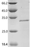 Human Lysophospholipase D GDPD3 (GDPD3), partial Recombinant Protein - BioCrest Sci