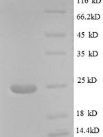 Human papillomavirus type 18  L1 protein (L1), partial Recombinant Protein - BioCrest Sci