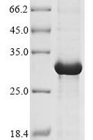 Human Granzyme K (GZMK) Recombinant Protein, N-His - BioCrest Sci