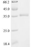 Sus scrofa Platelet-derived growth factor subunit B Recombinant Protein, C-His - BioCrest Sci