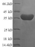 Human Islet cell autoantigen 1 (ICA1), partial Recombinant Protein - BioCrest Sci