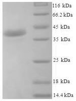 Human Josephin-1 (JOSD1) Recombinant Protein - BioCrest Sci