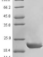 Dog Calcitonin (CALCA), partial Recombinant Protein - BioCrest Sci
