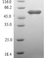 Human RING finger and CHY zinc finger domain-containing protein 1 (RCHY1) Recombinant Protein - BioCrest Sci