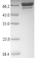 Influenza A virus Nucleoprotein (NP) Recombinant Protein, N-His-SUMO, aa 1–498, strain A/Wilson-Smith/1933 H1N1 - BioCrest Sci