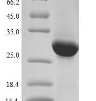 Human Phospholipid phosphatase-related protein type 2 (PLPPR2), partial Recombinant Protein, N-His-B2M - BioCrest Sci
