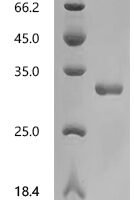 Human Prostate-specific antigen (KLK3) Recombinant Protein - BioCrest Sci