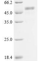 Human Na (+)/H (+) exchange regulatory cofactor NHE-RF1 (NHERF1) Recombinant Protein, N-10His - BioCrest Sci