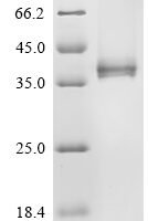Human Interleukin-12 receptor subunit beta-2 (IL12RB2), partial Recombinant Protein, C-10His, aa 24–317 - BioCrest Sci
