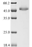 Escherichia coli NAD-dependent dihydropyrimidine dehydrogenase subunit PreA (preA) Recombinant Protein - BioCrest Sci