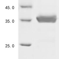 Human Free fatty acid receptor 3 (FFAR3), partial Recombinant Protein - BioCrest Sci