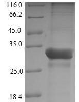Theragra chalcogramma Parvalbumin beta-1 Recombinant Protein - BioCrest Sci