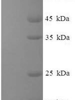 Hepatitis E virus genotype 1 Secreted protein ORF2 (ORF2), partial Recombinant Protein, N-His-SUMO - BioCrest Sci