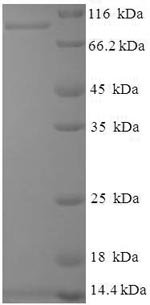 Hepatitis E virus genotype 1 Secreted protein ORF2 (ORF2), partial Recombinant Protein, N-His-SUMO, Hepatitis E virus genotype 1 (isolate Human/Pakistan/Sar-55) (HEV-1), E.coli, N-terminal 6xHis-SUMO-tagged, 84.8 kDa, purity >≥ 90% as determined by SDS-PAGE.