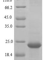Pongo abelii Transmembrane protein 168 (TMEM168), partial Recombinant Protein, N-10His/C-Myc, aa 527–637, E.coli - BioCrest Sci