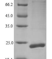 Escherichia coli Outer-membrane lipoprotein carrier protein (lolA) Recombinant Protein - BioCrest Sci