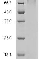 Human Pseudokinase FAM20A (FAM20A) Recombinant Protein, N-xlnB/C-His - BioCrest Sci